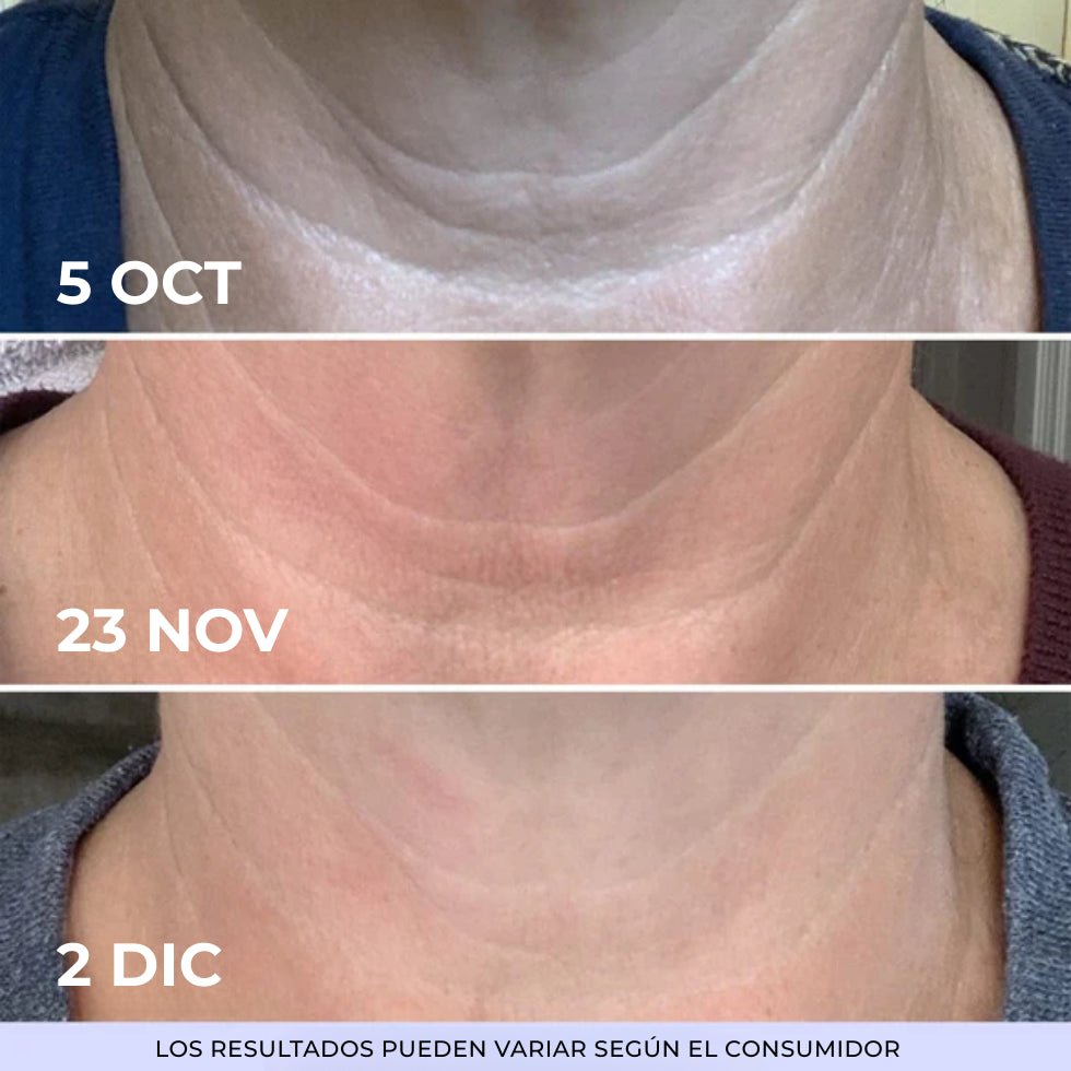 1+1 GRATIS GOPURE | Crema Reafirmante y Lifting para el Cuello