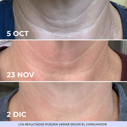 1+1 GRATIS GOPURE | Crema Reafirmante y Lifting para el Cuello