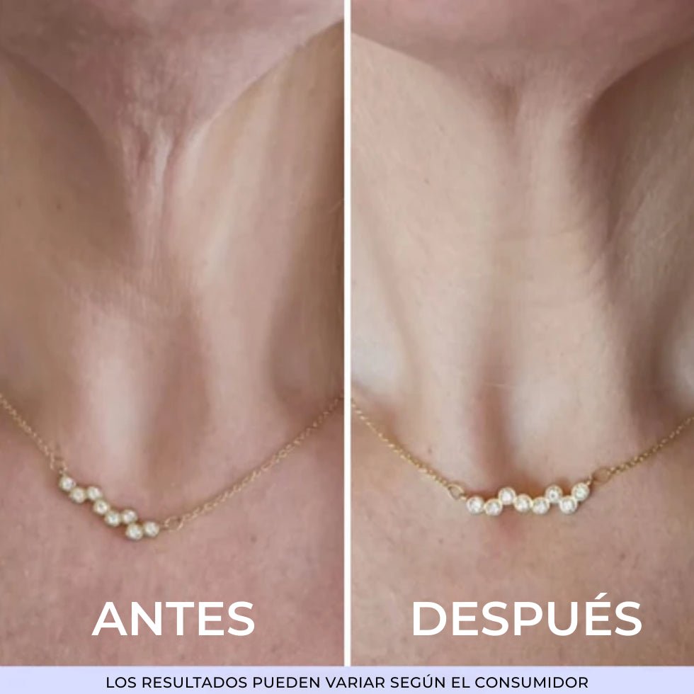 1+1 GRATIS GOPURE | Crema Reafirmante y Lifting para el Cuello