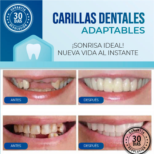 2X1 BESMILE | Carillas Dentales Adaptables