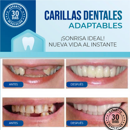 2X1 BESMILE | Carillas Dentales Adaptables