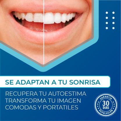 2X1 BESMILE | Carillas Dentales Adaptables